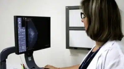 Ministério da Saúde amplia acesso à mamografia para até 74 anos no SUS