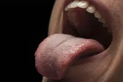 Biossensor detecta depressão e esquizofrenia na saliva com baixo custo Biossensor detecta depressão e esquizofrenia na saliva com baixo custo