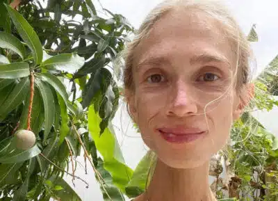 Karolina Krzyżak morre em Indonésia após dieta restritiva e peso de 22kg
